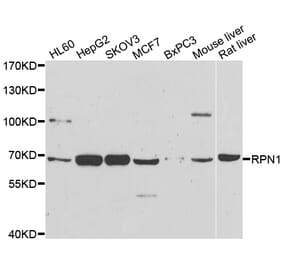Western blot - RPN1 antibody from Signalway Antibody (39133) - Antibodies.com