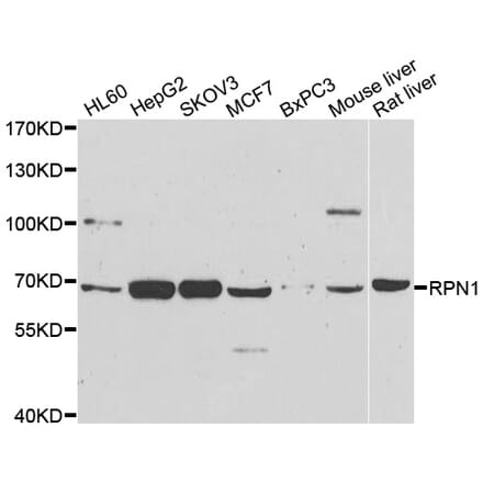 Western blot - RPN1 antibody from Signalway Antibody (39133) - Antibodies.com