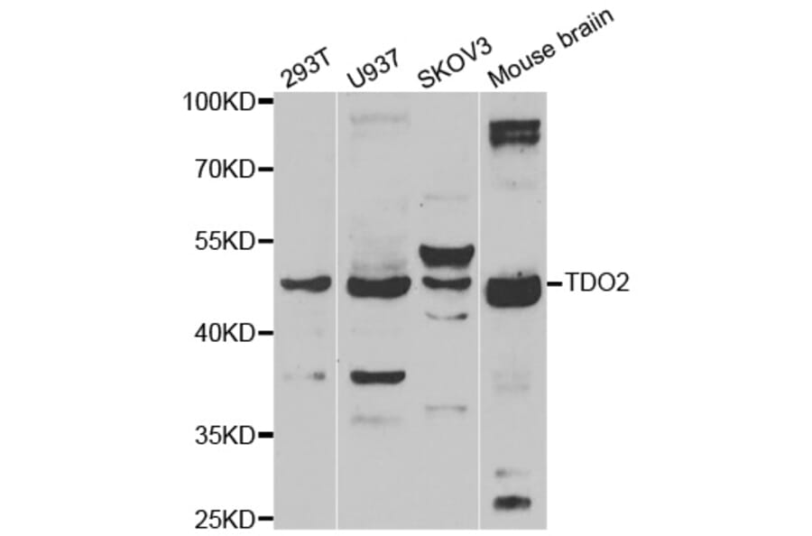 Western blot - TDO2 antibody from Signalway Antibody (39164) - Antibodies.com