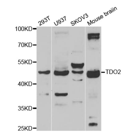 Western blot - TDO2 antibody from Signalway Antibody (39164) - Antibodies.com