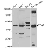 Western blot - TDO2 antibody from Signalway Antibody (39164) - Antibodies.com