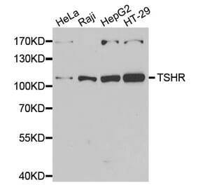 Western blot - TSHR antibody from Signalway Antibody (39177) - Antibodies.com