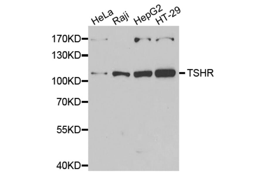 Western blot - TSHR antibody from Signalway Antibody (39177) - Antibodies.com
