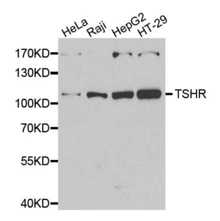 Western blot - TSHR antibody from Signalway Antibody (39177) - Antibodies.com