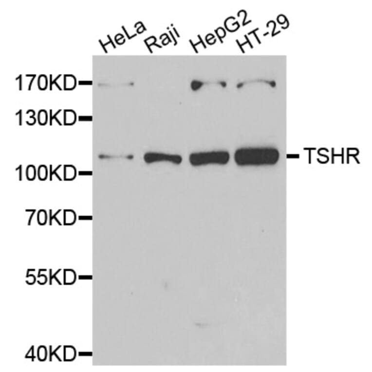 Western blot - TSHR antibody from Signalway Antibody (39177) - Antibodies.com