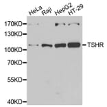 Western blot - TSHR antibody from Signalway Antibody (39177) - Antibodies.com