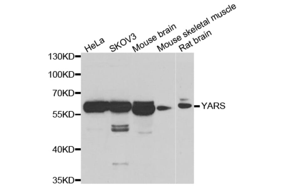 Western blot - YARS antibody from Signalway Antibody (39183) - Antibodies.com