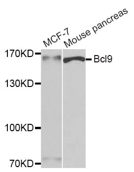 Western blot analysis of extracts of various cell lines, using Bcl9 antibody.