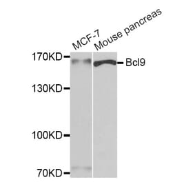 Western blot - Bcl9 antibody from Signalway Antibody (39184) - Antibodies.com