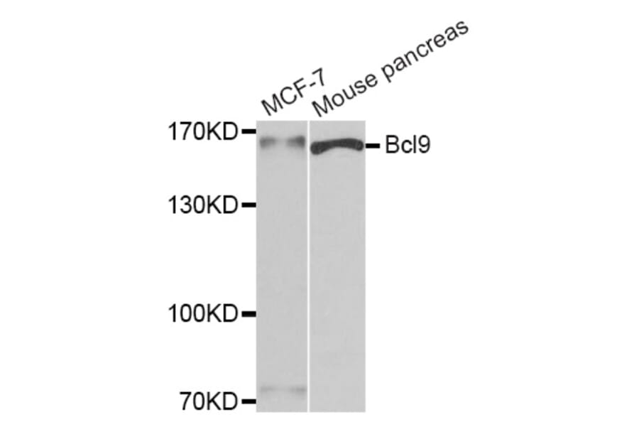 Western blot - Bcl9 antibody from Signalway Antibody (39184) - Antibodies.com
