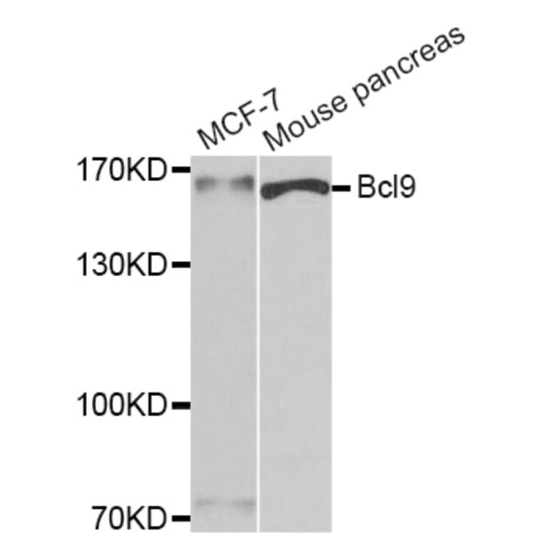 Western blot - Bcl9 antibody from Signalway Antibody (39184) - Antibodies.com