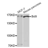 Western blot - Bcl9 antibody from Signalway Antibody (39184) - Antibodies.com