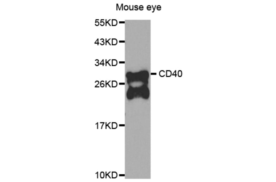 Western blot - CD40 antibody from Signalway Antibody (39204) - Antibodies.com