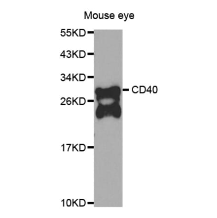 Western blot - CD40 antibody from Signalway Antibody (39204) - Antibodies.com