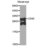 Western blot - CD40 antibody from Signalway Antibody (39204) - Antibodies.com