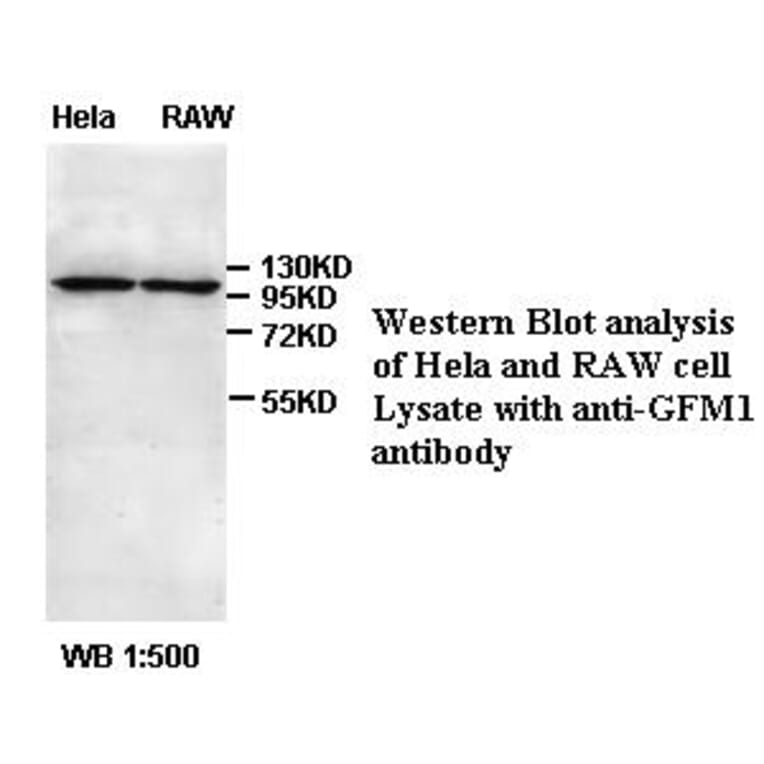 GFM1 Antibody from Signalway Antibody (39390) - Antibodies.com