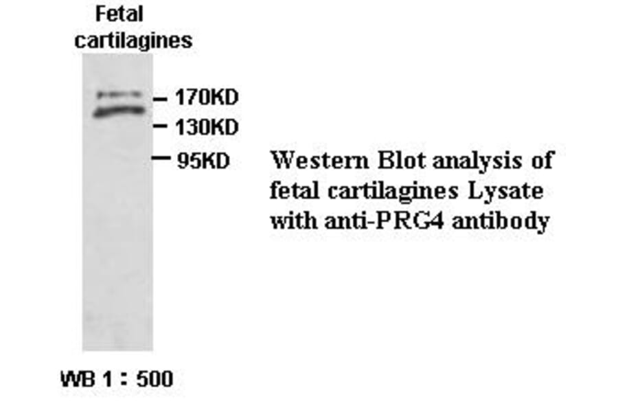 PRG4 Antibody from Signalway Antibody (39393) - Antibodies.com