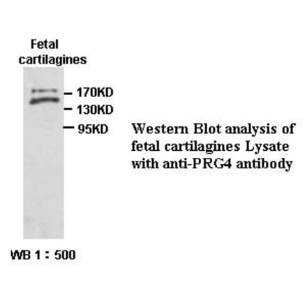 PRG4 Antibody from Signalway Antibody (39393) - Antibodies.com