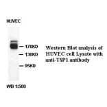 TSP1 Antibody from Signalway Antibody (39409) - Antibodies.com
