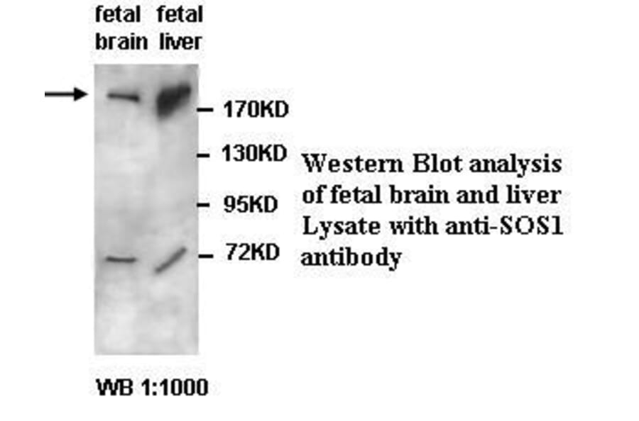 SOS1 Antibody from Signalway Antibody (39432) - Antibodies.com