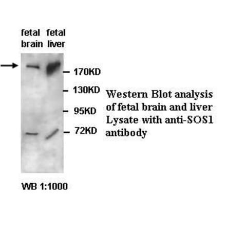 SOS1 Antibody from Signalway Antibody (39432) - Antibodies.com