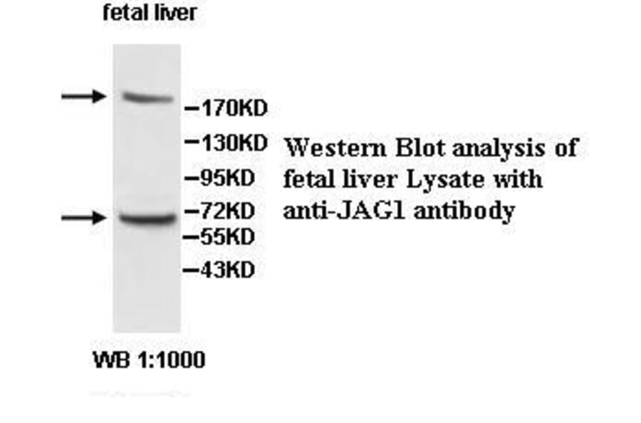 JAG1 Antibody from Signalway Antibody (39567) - Antibodies.com