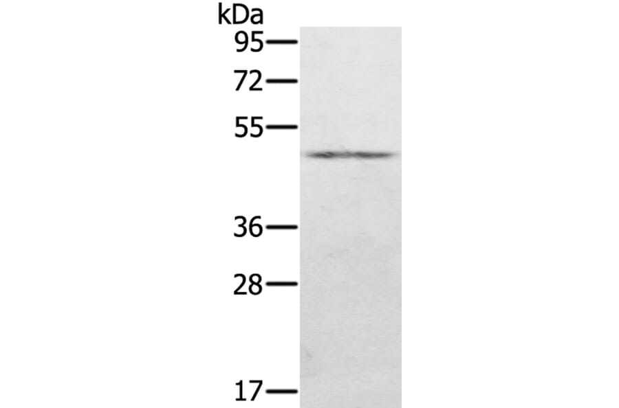 KDM8 Antibody from Signalway Antibody (40061) - Antibodies.com