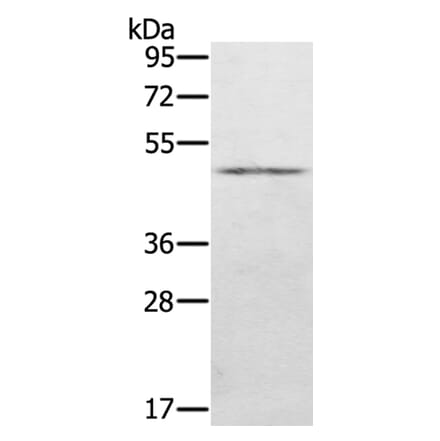KDM8 Antibody from Signalway Antibody (40061) - Antibodies.com