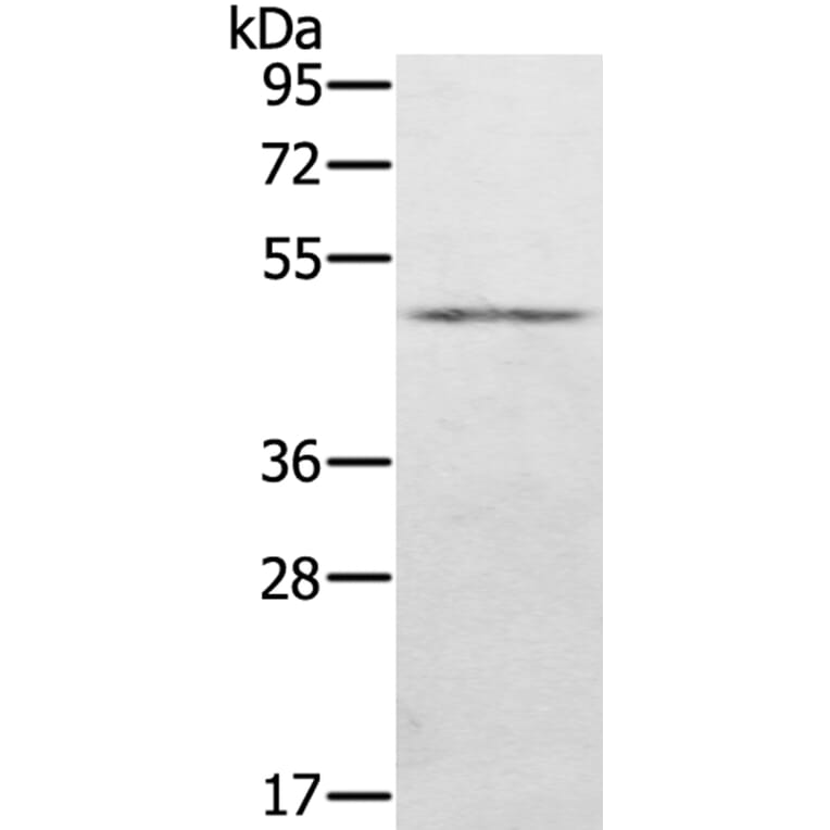 KDM8 Antibody from Signalway Antibody (40061) - Antibodies.com