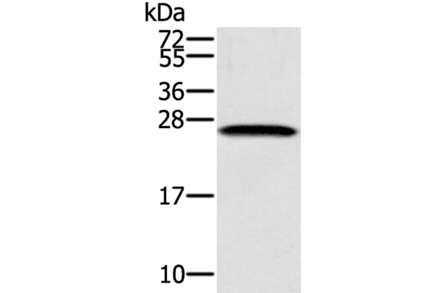 SSX1 Antibody from Signalway Antibody (40118) - Antibodies.com