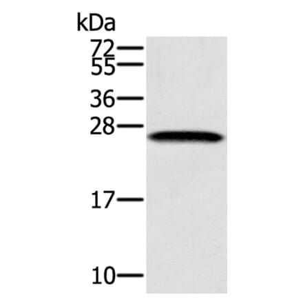 SSX1 Antibody from Signalway Antibody (40118) - Antibodies.com