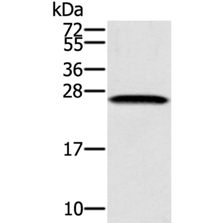 SSX1 Antibody from Signalway Antibody (40118) - Antibodies.com