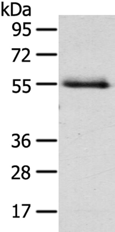 Gel: 8% SDS-PAGE Lysate: 40ug Human normal liver tissue. Primary antibody: 1/200 dilution Secondary antibody dilution: 1/8000Exposure time: 1 minute