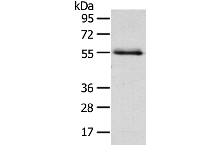 NUF2 Antibody from Signalway Antibody (40196) - Antibodies.com