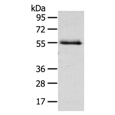 NUF2 Antibody from Signalway Antibody (40196) - Antibodies.com