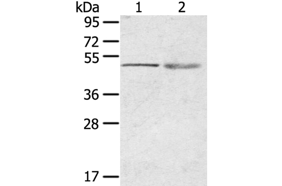 RHCE Antibody from Signalway Antibody (40210) - Antibodies.com