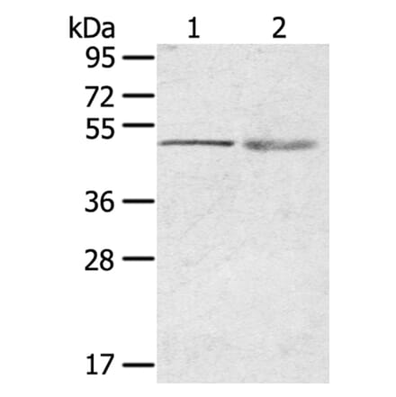 RHCE Antibody from Signalway Antibody (40210) - Antibodies.com