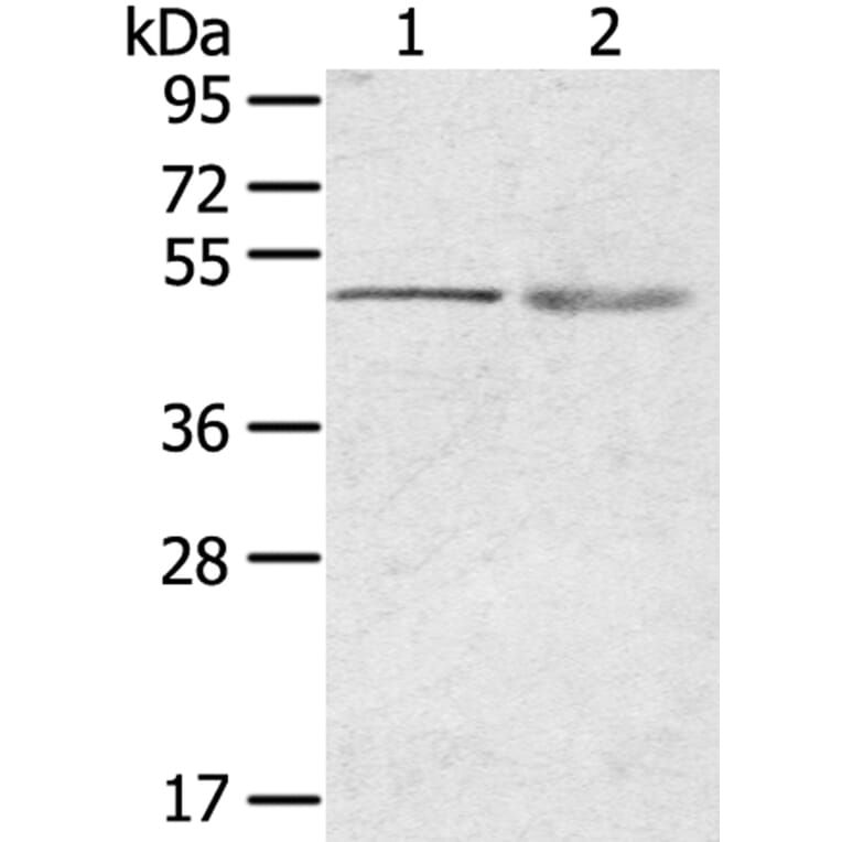 RHCE Antibody from Signalway Antibody (40210) - Antibodies.com