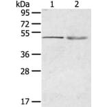 RHCE Antibody from Signalway Antibody (40210) - Antibodies.com