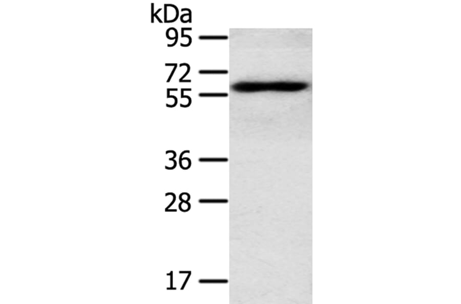 RORA Antibody from Signalway Antibody (40212) - Antibodies.com