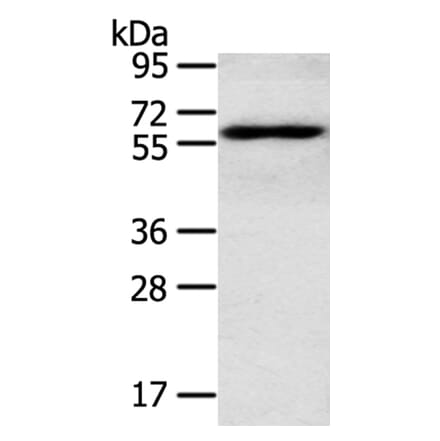 RORA Antibody from Signalway Antibody (40212) - Antibodies.com