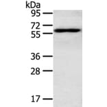 RORA Antibody from Signalway Antibody (40212) - Antibodies.com