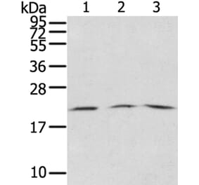 SSX5 Antibody from Signalway Antibody (40374) - Antibodies.com