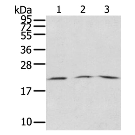 SSX5 Antibody from Signalway Antibody (40374) - Antibodies.com