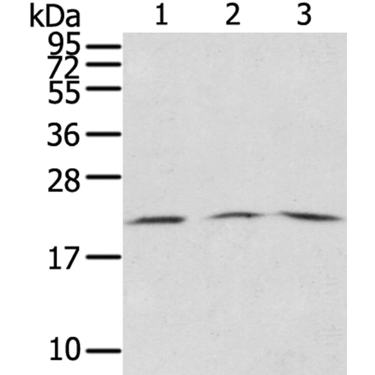 SSX5 Antibody from Signalway Antibody (40374) - Antibodies.com