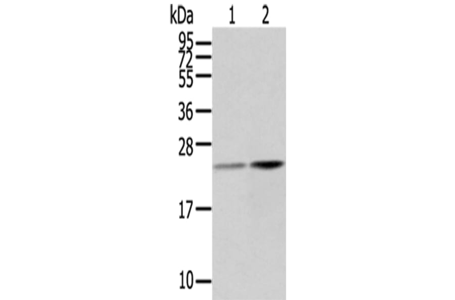 RBP4 Antibody from Signalway Antibody (42730) - Antibodies.com