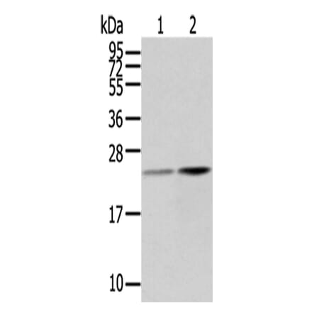 RBP4 Antibody from Signalway Antibody (42730) - Antibodies.com