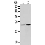 RBP4 Antibody from Signalway Antibody (42730) - Antibodies.com