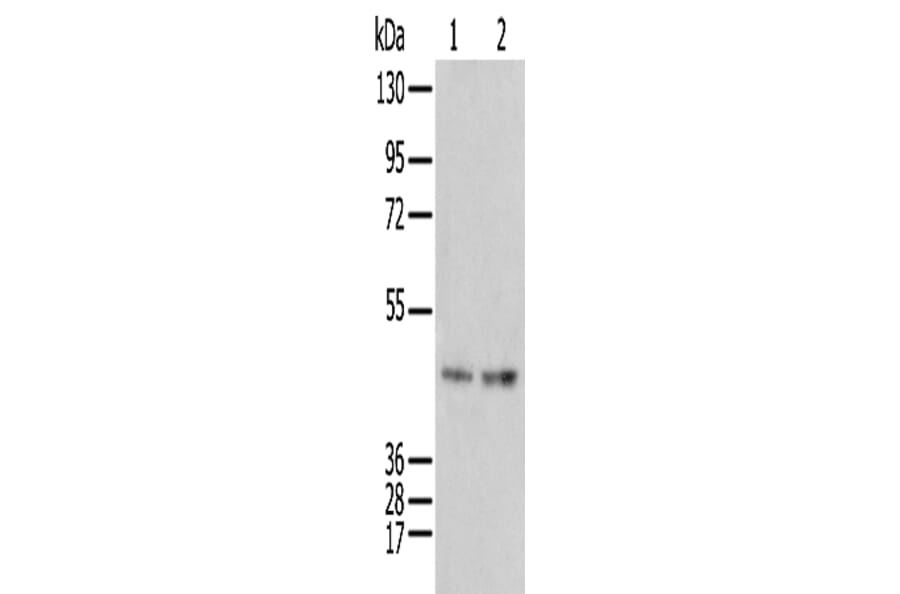 IDO2 Antibody from Signalway Antibody (42936) - Antibodies.com