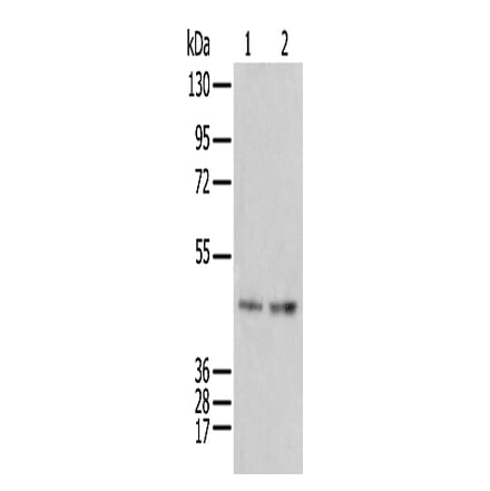 IDO2 Antibody from Signalway Antibody (42936) - Antibodies.com